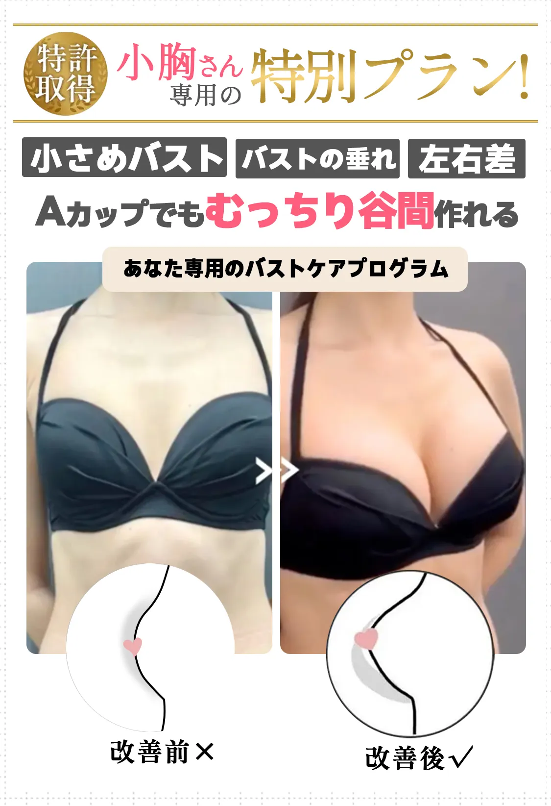 豊胸薬